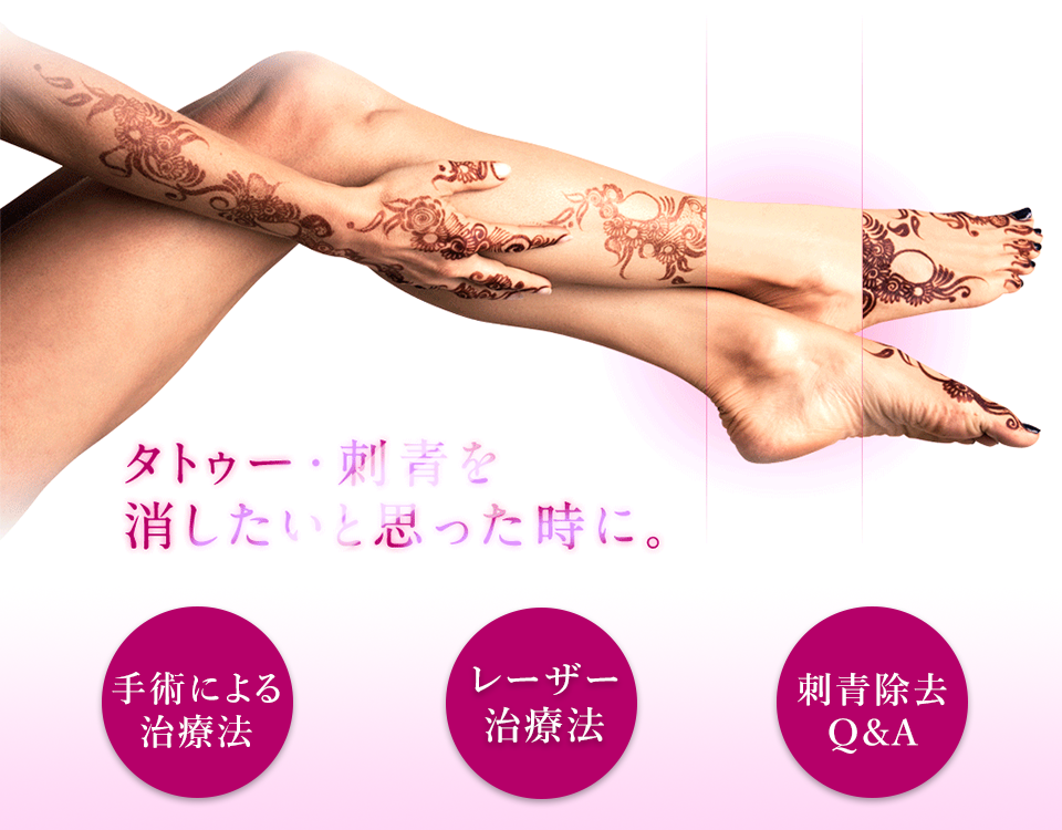 タトゥー・刺青を消したいと思った時に